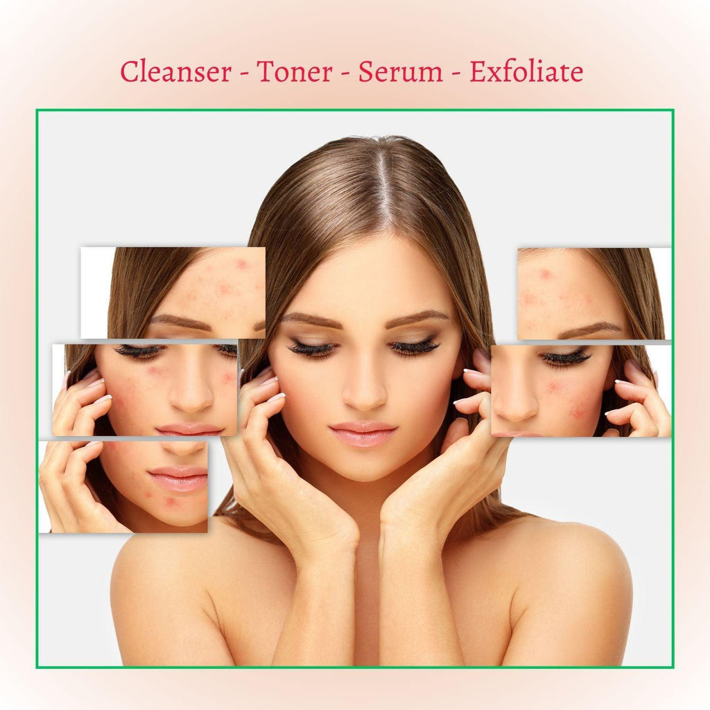 Perfect Trifecta AHA Resurfacing Peel