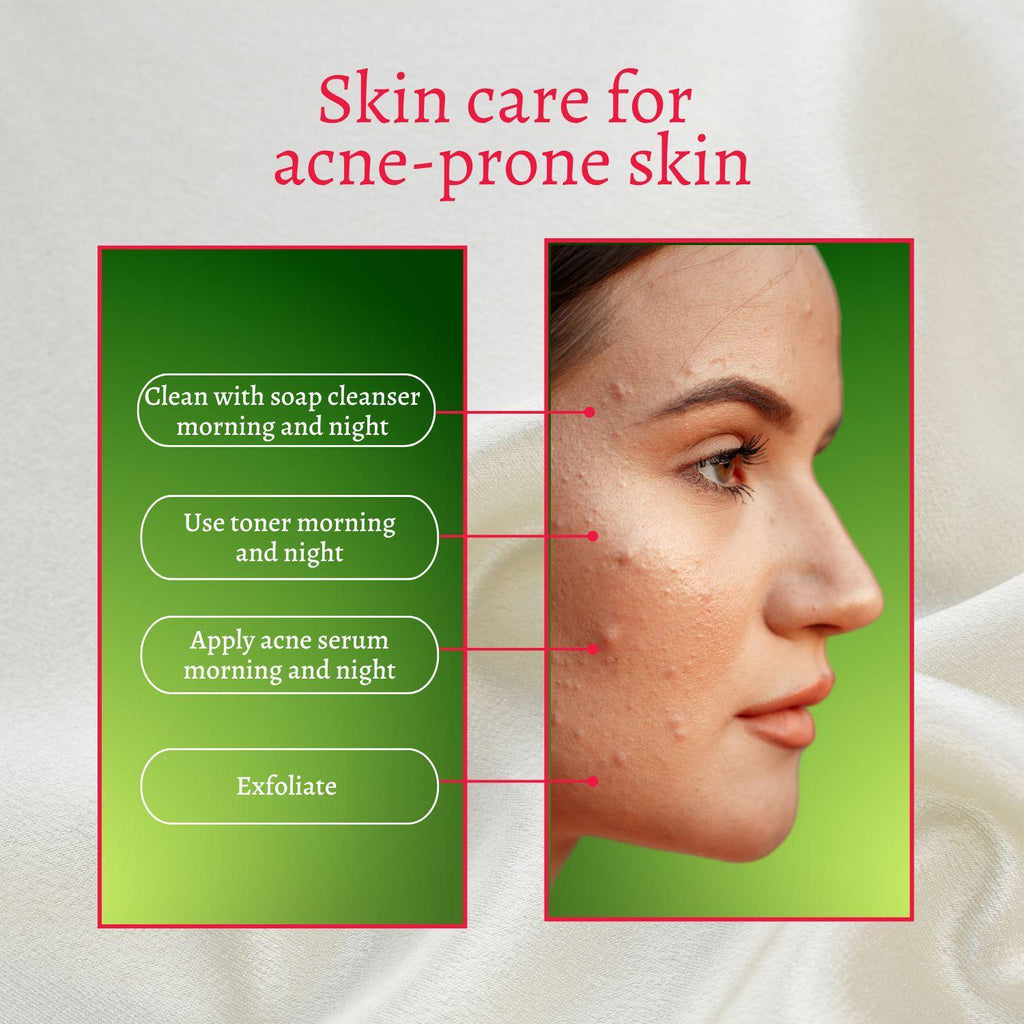 Perfect Trifecta AHA Resurfacing Peel
