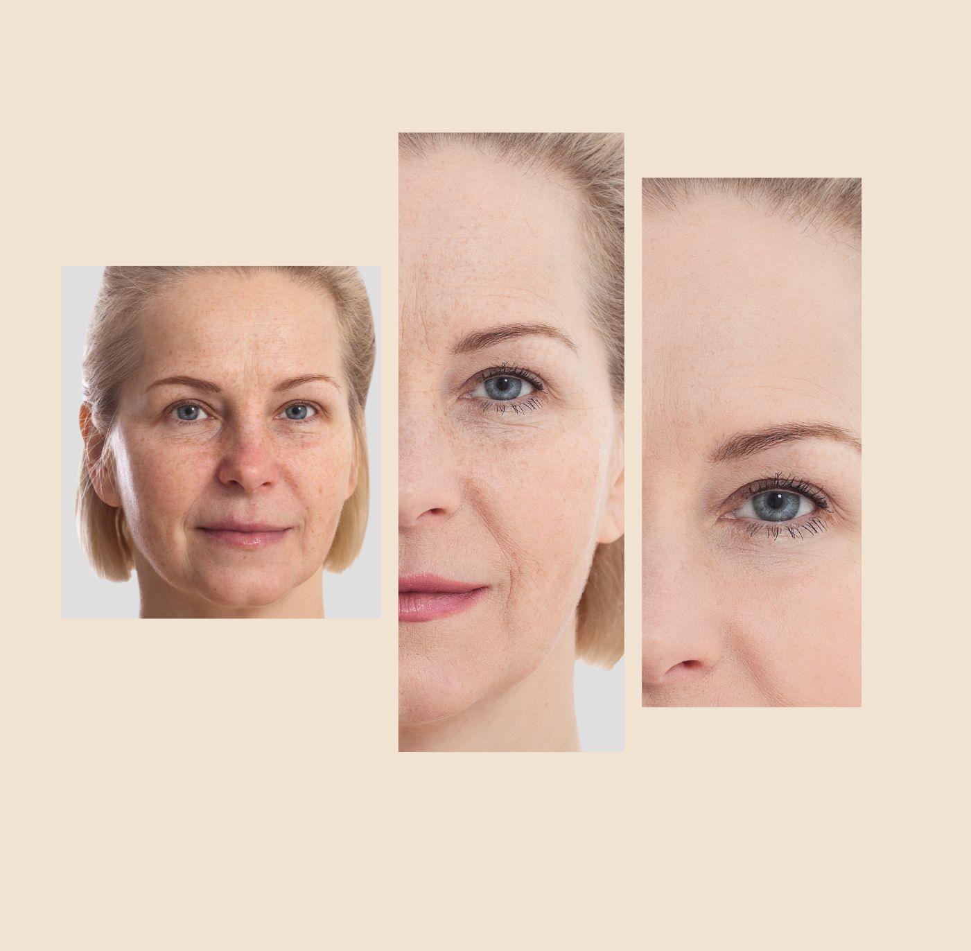 The Eraser Spot Cream | Dark Spot Correcting Moisturizer
