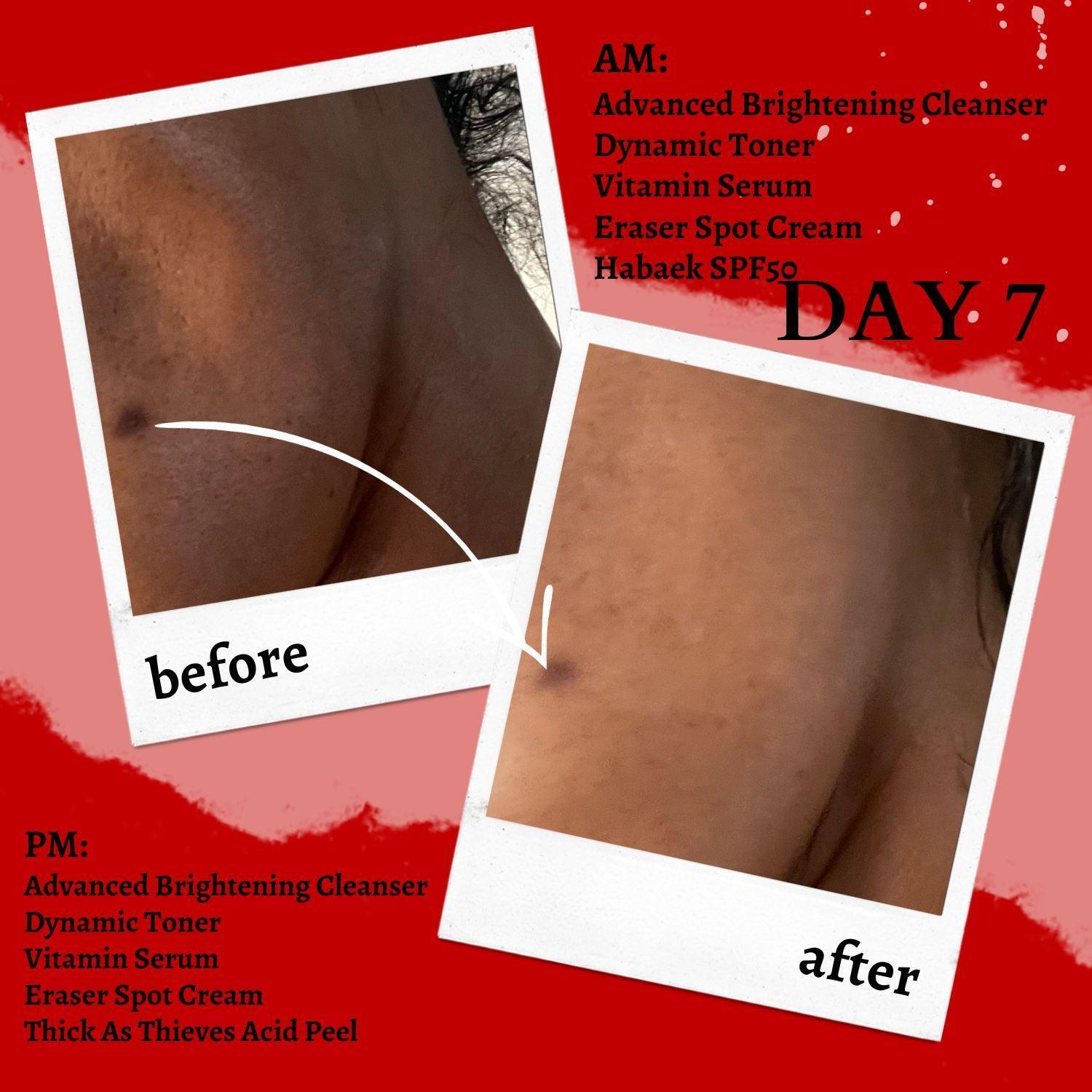 The Eraser Spot Cream | Dark Spot Correcting Moisturizer