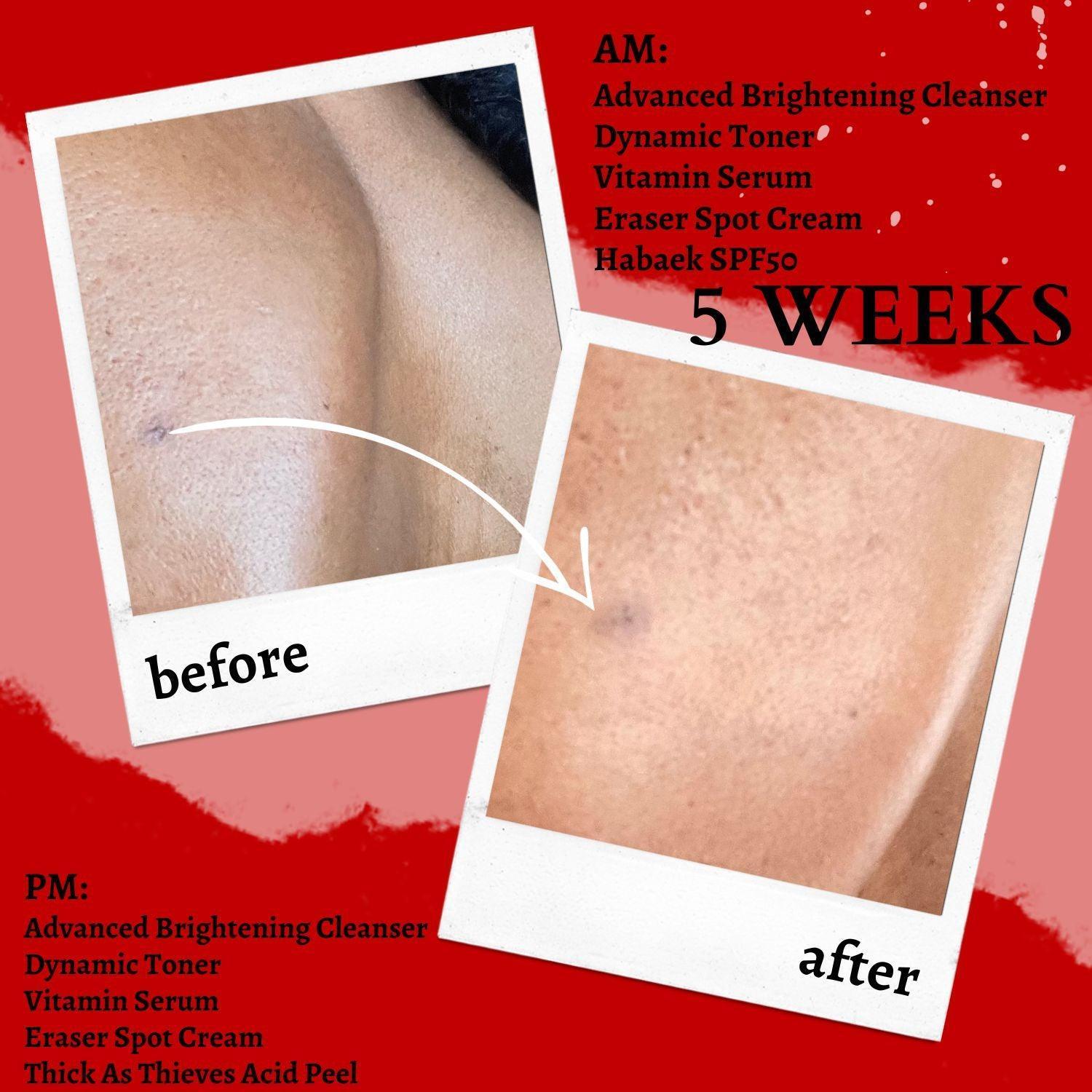 The Eraser Spot Cream | Dark Spot Correcting Moisturizer